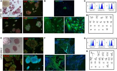 Human-Induced Pluripotent Stem Cells Manufactured Using a Current Good Manufacturing Practice-Compliant Process Differentiate Into Clinically Relevant Cells From Three Germ Layers